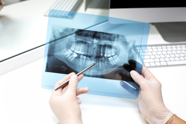 Permanent and Healthy Smiles with Implant Treatment