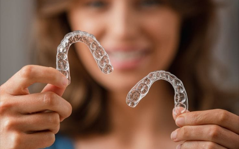 Clear Aligner Treatment